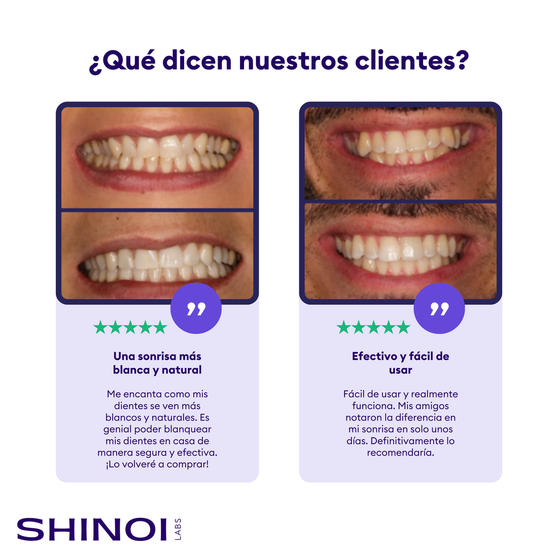 Mejor blanqueador dental según la OCU