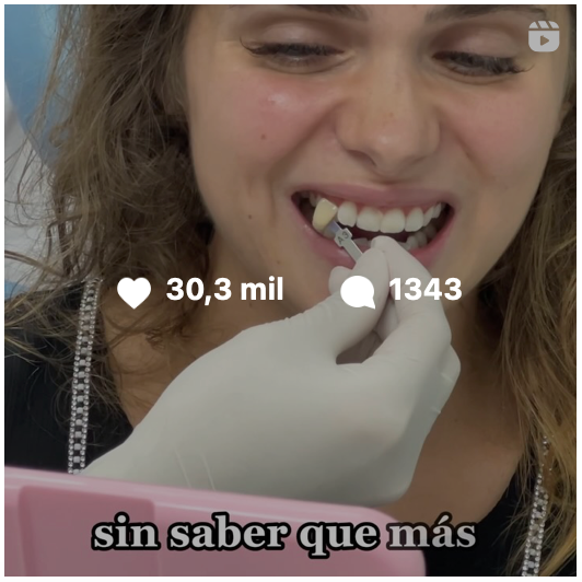 Marina Yers en su blanqueamiento dental