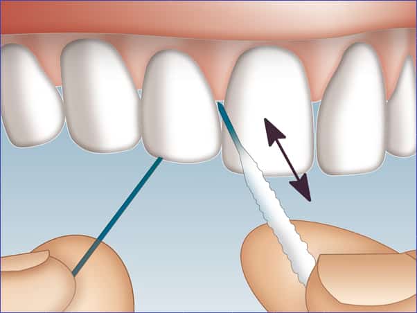 Hilo dental, ¿antes o después del cepillado?